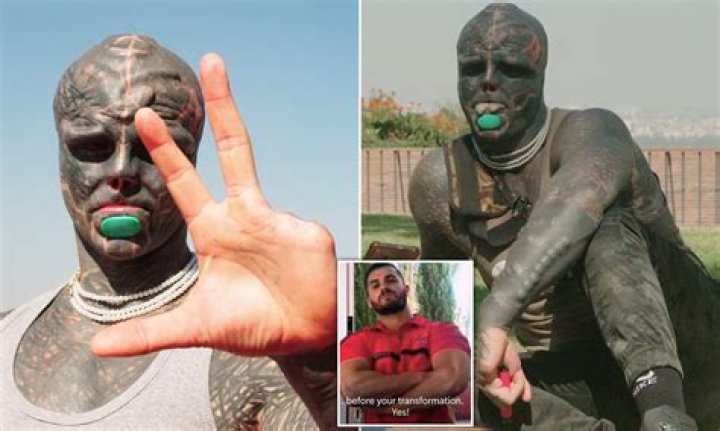 Who Is Anthony Loffredo Wife? Before And After Photos Of The Most Modified Man Who Chopped Off Two Fingers